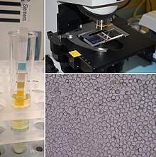 Urinalysis collage.jpg