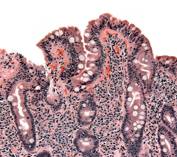 File:Coeliac path.jpg