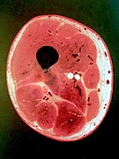 Photo of cross-sectional slice from a plastinated human thigh.