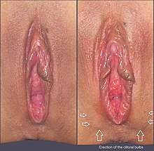 Female vulva 4 a.jpg