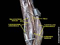 Muscles of the back of the leg. Deep layer.