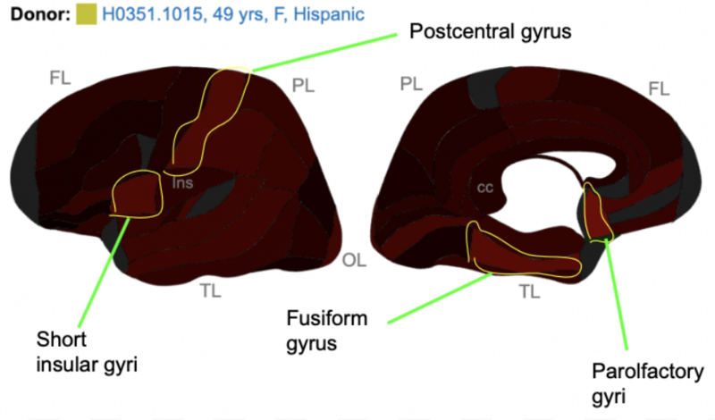 File:ZNF839 Brain Expression.png