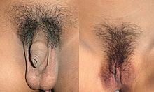 Pubic hair male-female.jpg