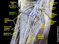 Femoral artery