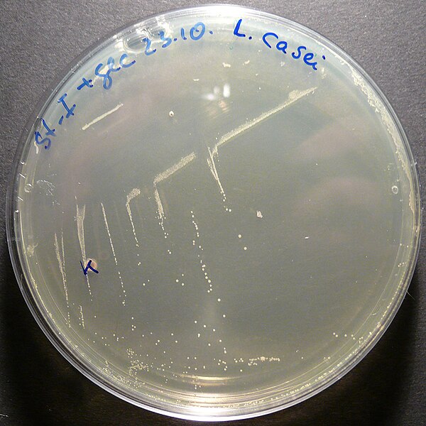 File:Lactobacillus casei 1.jpg