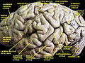 Cerebrum. Lateral view. Deep dissection.