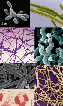 Prokaryotes collage