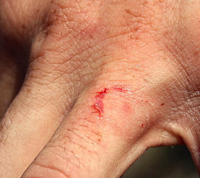 File:Triggerfish bite.JPG