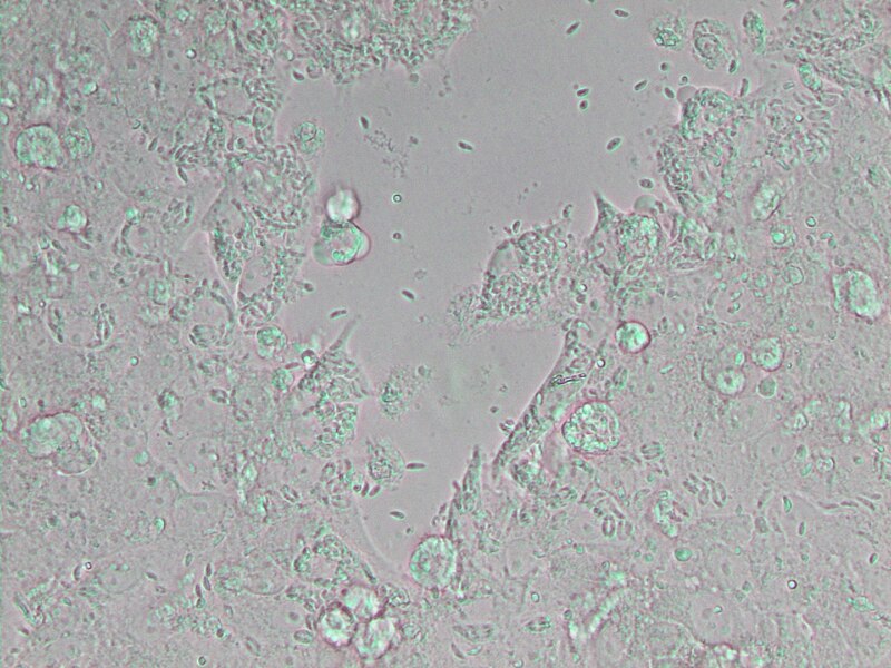 File:Neospora caninum (5256961091).jpg