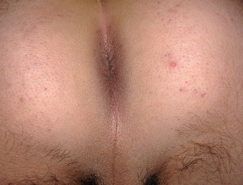 File:Anus of male.jpg