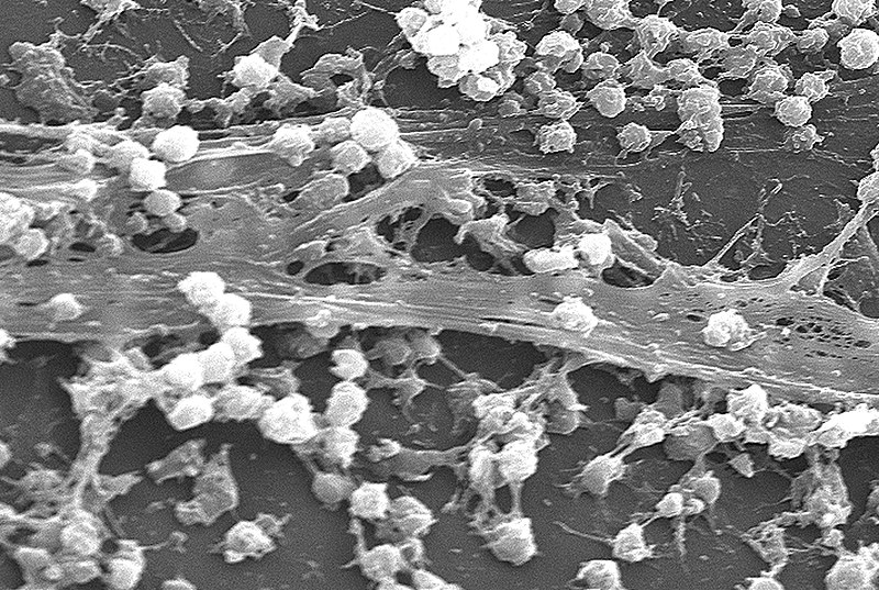 Archivo:Staphylococcus aureus biofilm 01.jpg