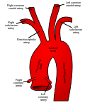 Thumbnail for Common carotid artery