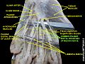 Common palmar digital branches of median nerve