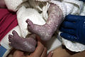 Vernix on a newborn's legs and feet.