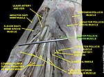 Flexor pollicis brevis muscle