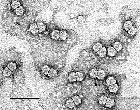 Очищенный вирус полосатости кукурузы (MSV), Geminiviridae, масштаб 50 нм.