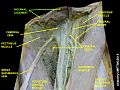 Inguinal ligament