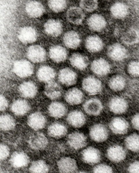 Файл:Adeno-associated viruses.jpg