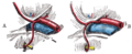 Variations in origin and course of obturator artery.