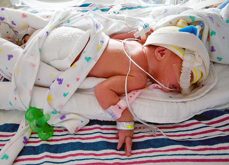 File:Mcmaster NICU infant 6978.jpg