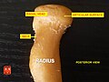 Posterior view. Radial tuberosity.