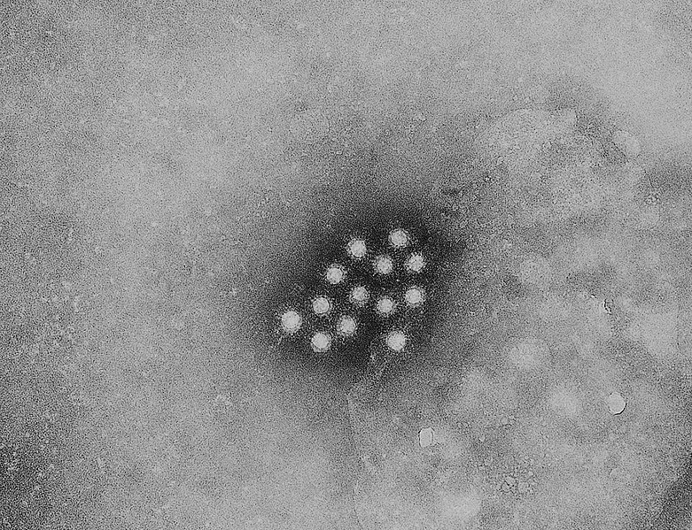 Файл:Hepatitis A virus 01.jpg