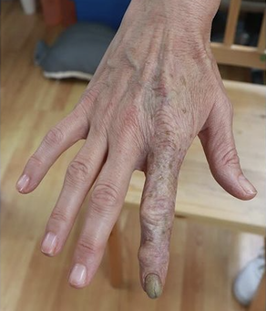 File:The Finger (prosthetics for The Substance).png