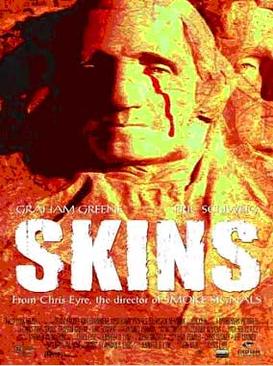 File:Skinsfilm.jpg