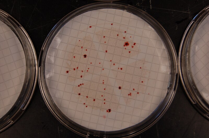 File:Enterococci colonies.JPG