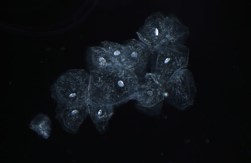 File:Cheek cells darkfield.jpg