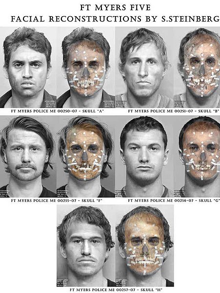 Файл:Facial Reconstruction.jpg